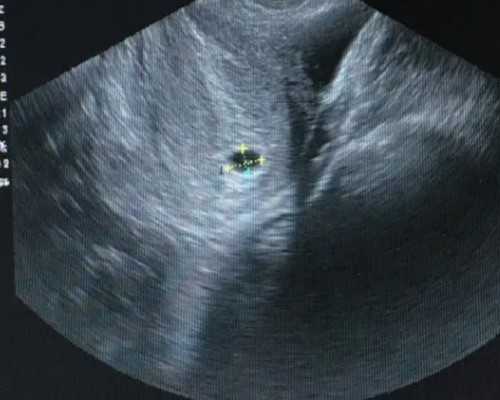不孕不育系统检查